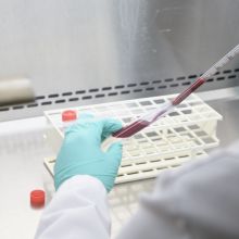 The antibody tests build upon the work of UArizona Health Sciences researchers Dr. Janko Nikolich-Žu
