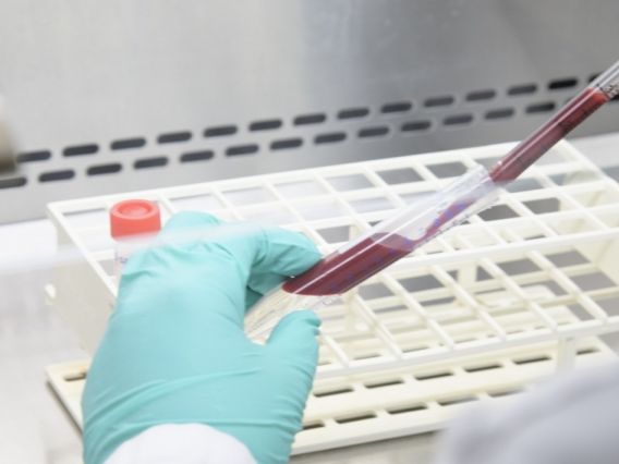 The antibody tests build upon the work of UArizona Health Sciences researchers Dr. Janko Nikolich-Žu